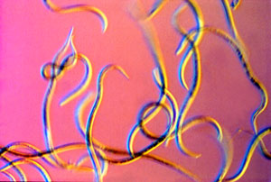 image of strongyloides ratti infective L3s